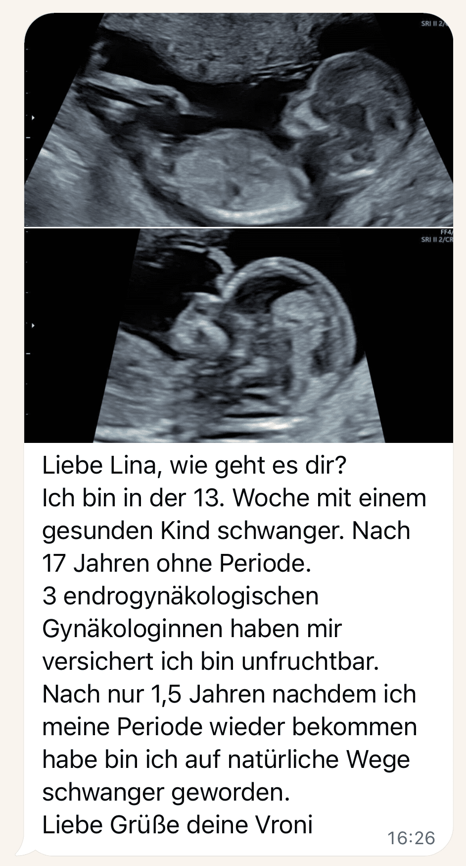 Ultraschallbilder und Vronis Nachricht: schwanger auf natürlichem Weg, nach 17 Jahren ohne Periode